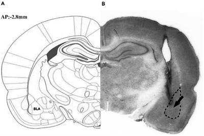 Norepinephrine Induces PTSD-Like Memory Impairments via Regulation of the β-Adrenoceptor-cAMP/PKA and CaMK II/PKC Systems in the Basolateral Amygdala